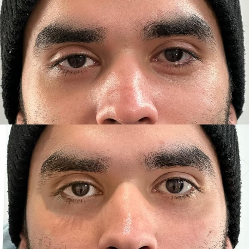 Revitalize your skin with growth-factor therapy from your own body.