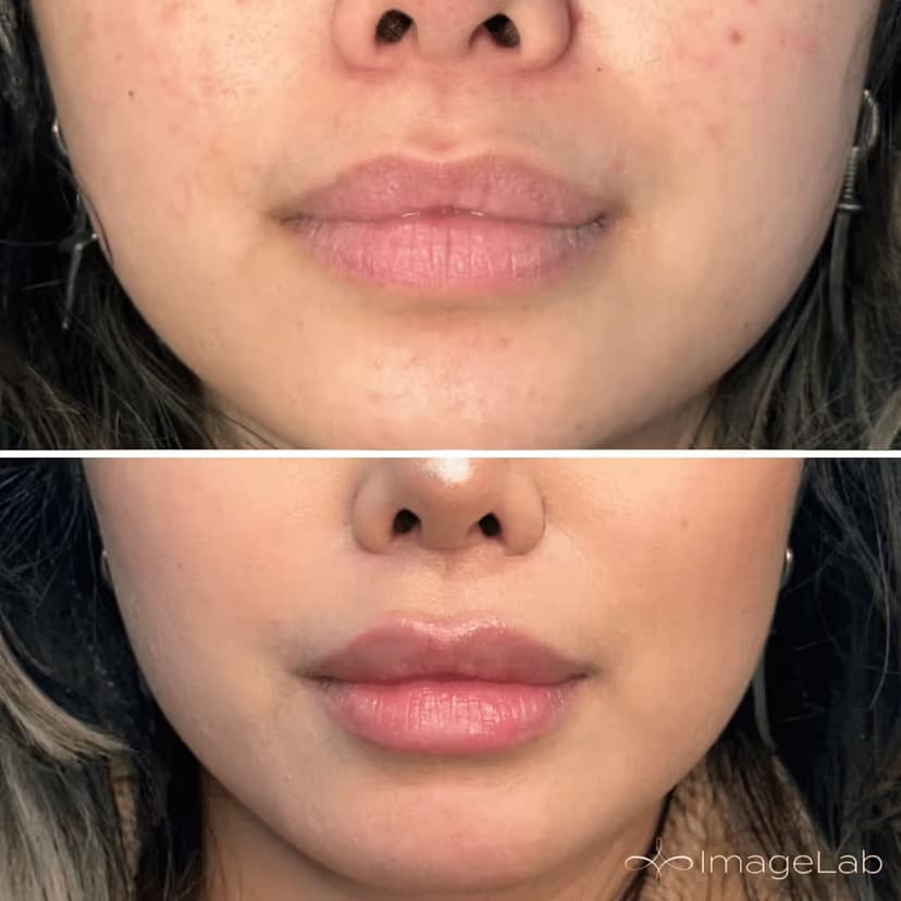Achieve beautifully defined, balanced lips with personalized care.