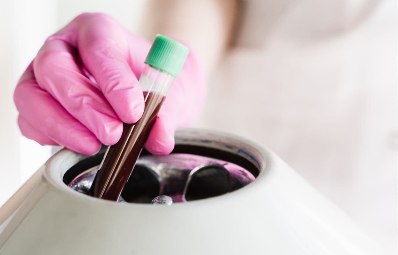 prp blood facial rockford il