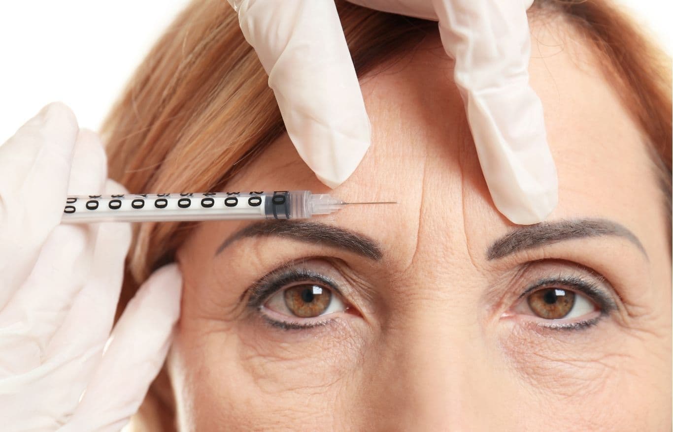 botox for wrinkles alexandria