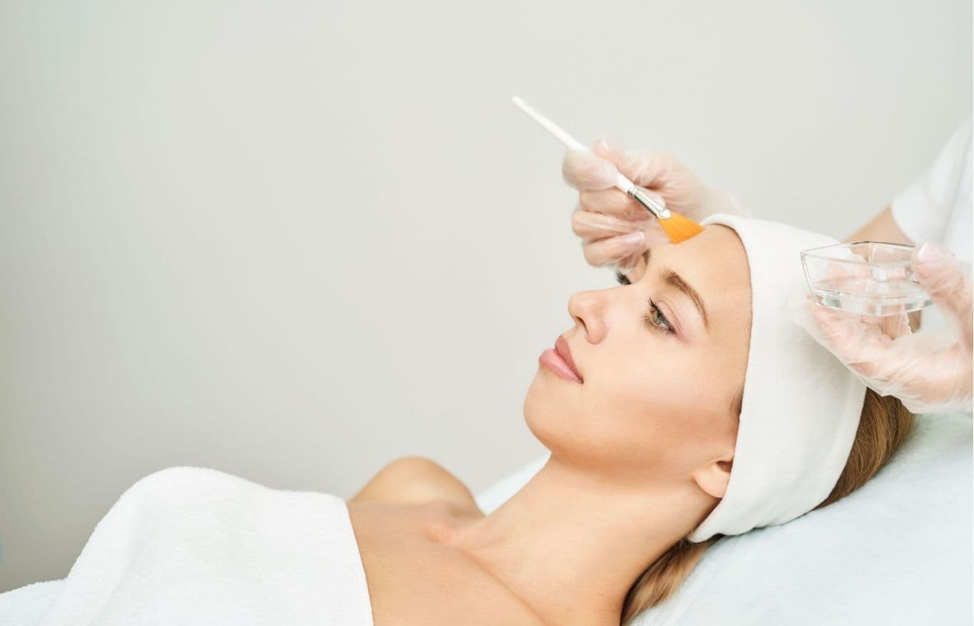 face chemical peels rockford il