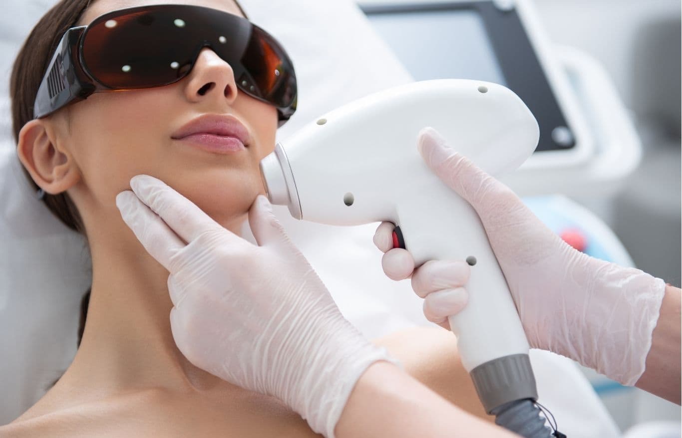 face laser hair removal rockford il