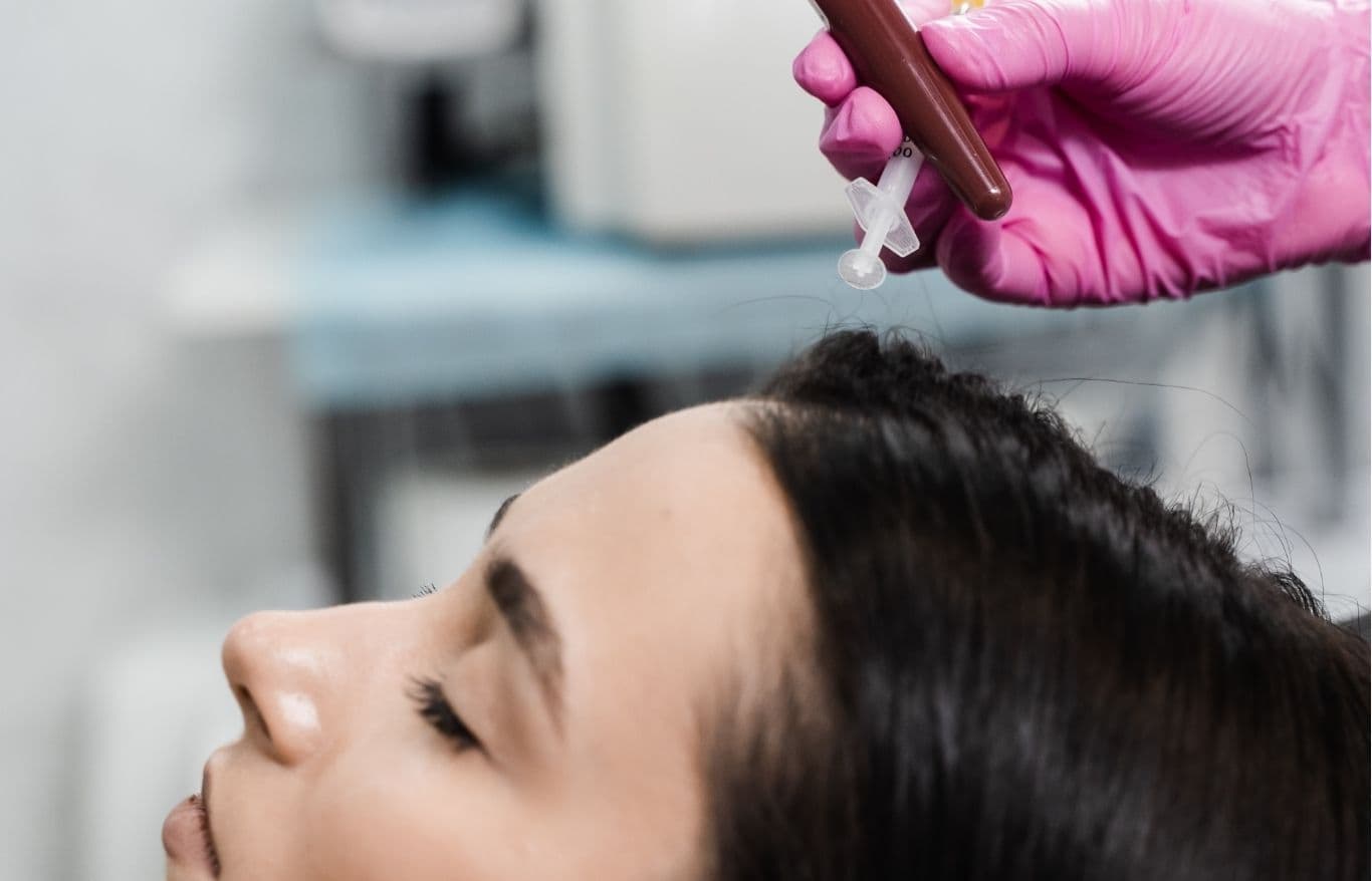 prp hair treatment rockford