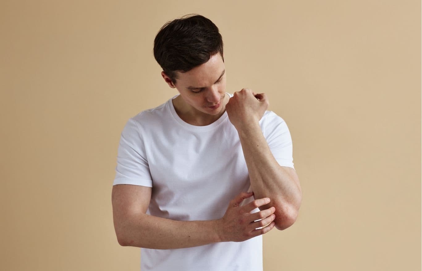 Active Skin Infections