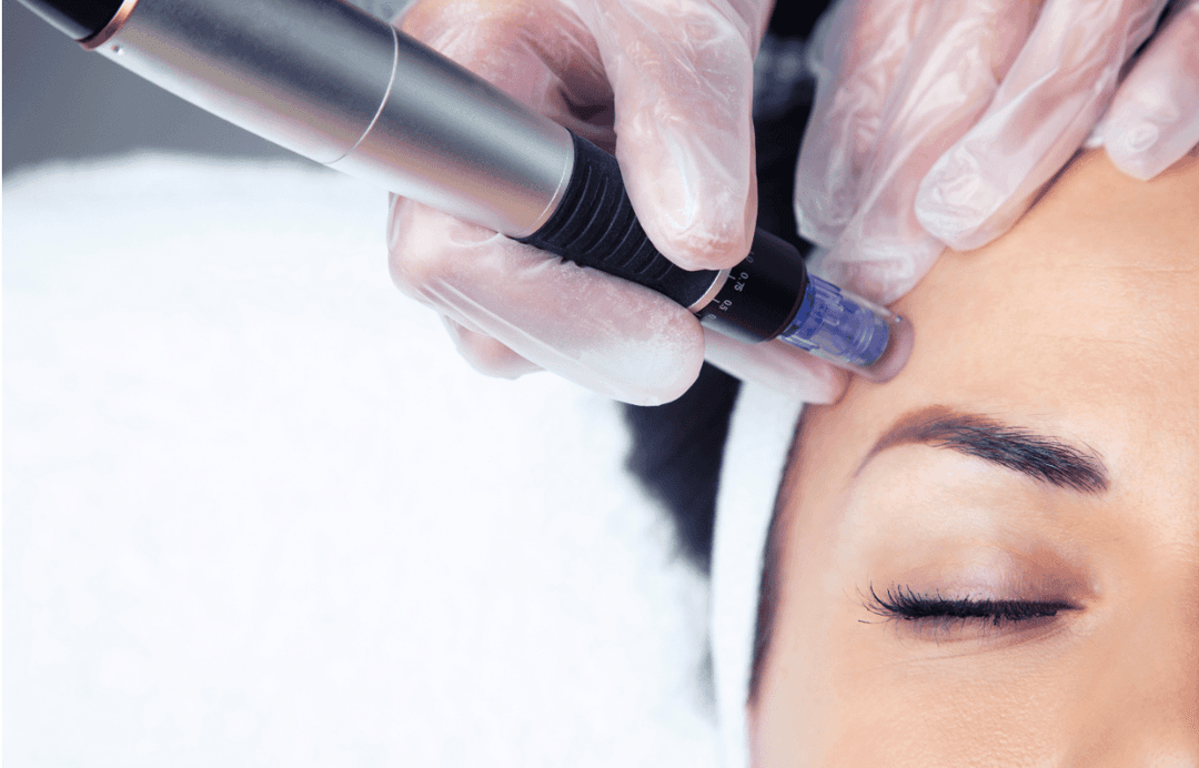 The Complete Guide to Anti-Wrinkle Treatments: Finding Your Perfect Match
