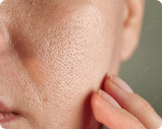 Skin Texture