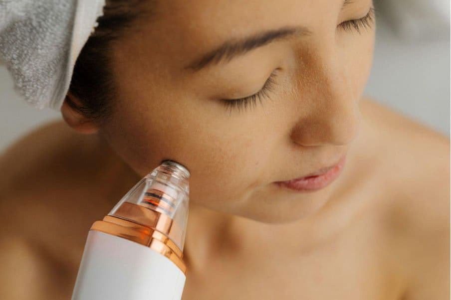 Why Microneedling is a Must-Try for Skin Renewal in Chicago
