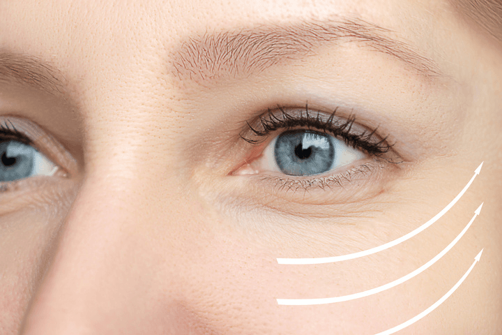 Are Dermal Fillers safe
