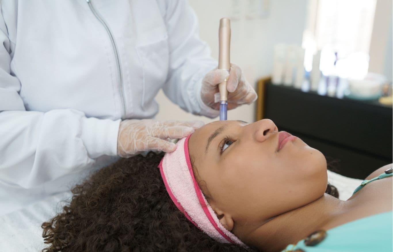 microneedling facial rockford il