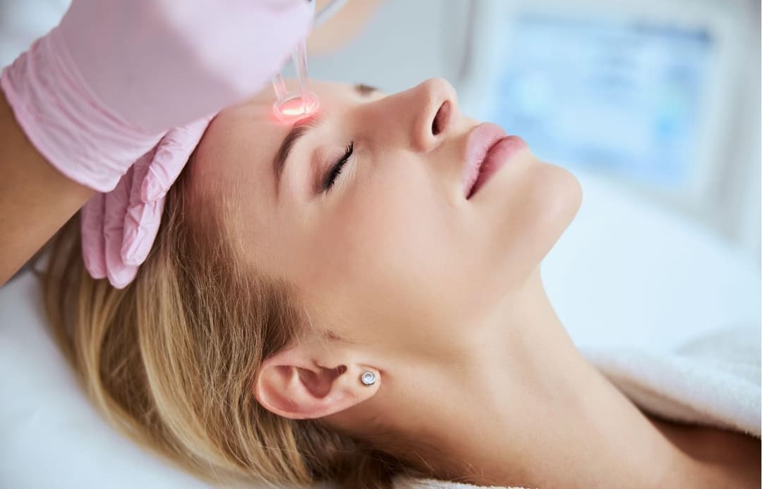laser facial resurfacing