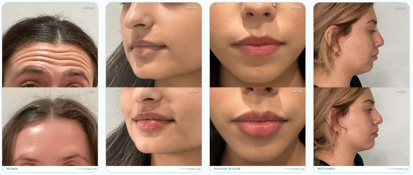 Before and after comparison photos of cosmetic treatments.