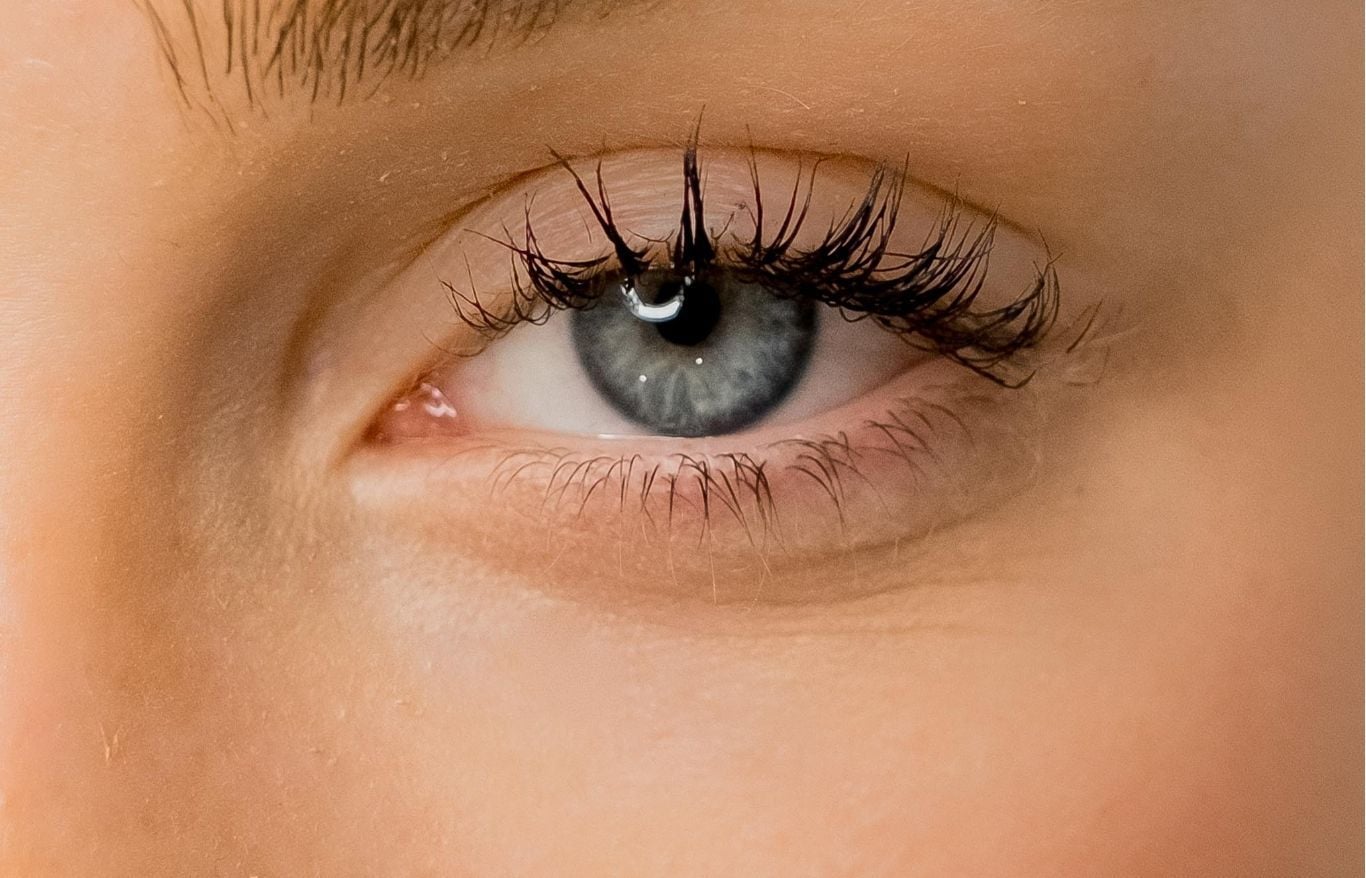 PRP Undereyes