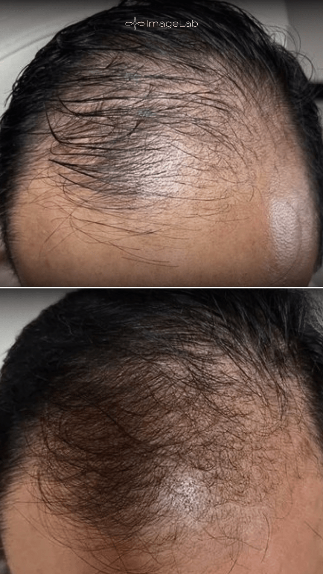 Before and after result
