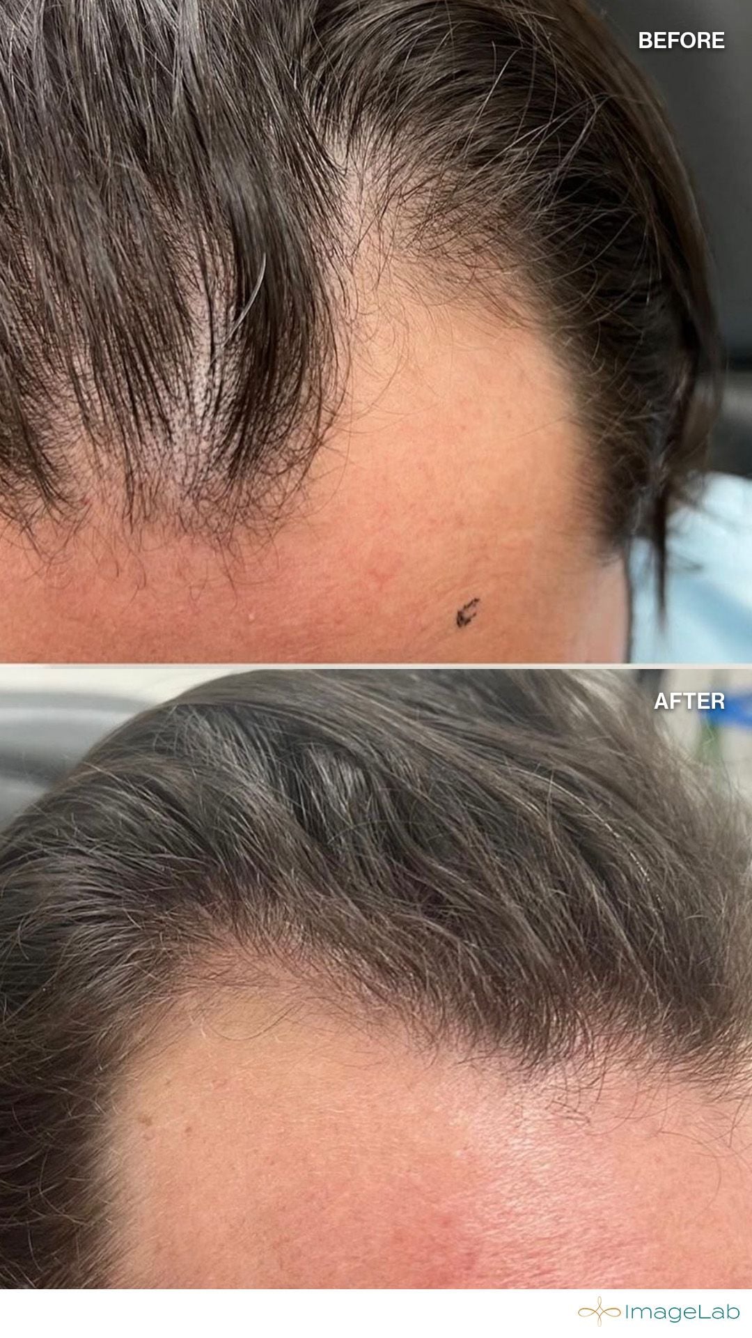Before and after result