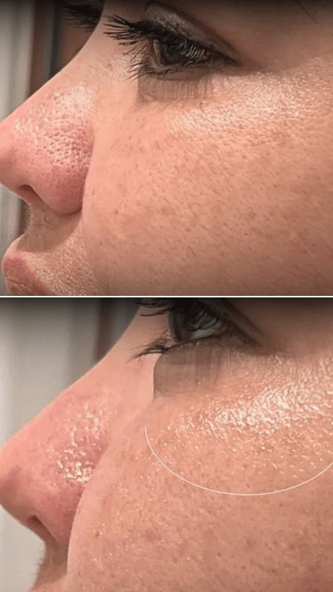 Before and after result