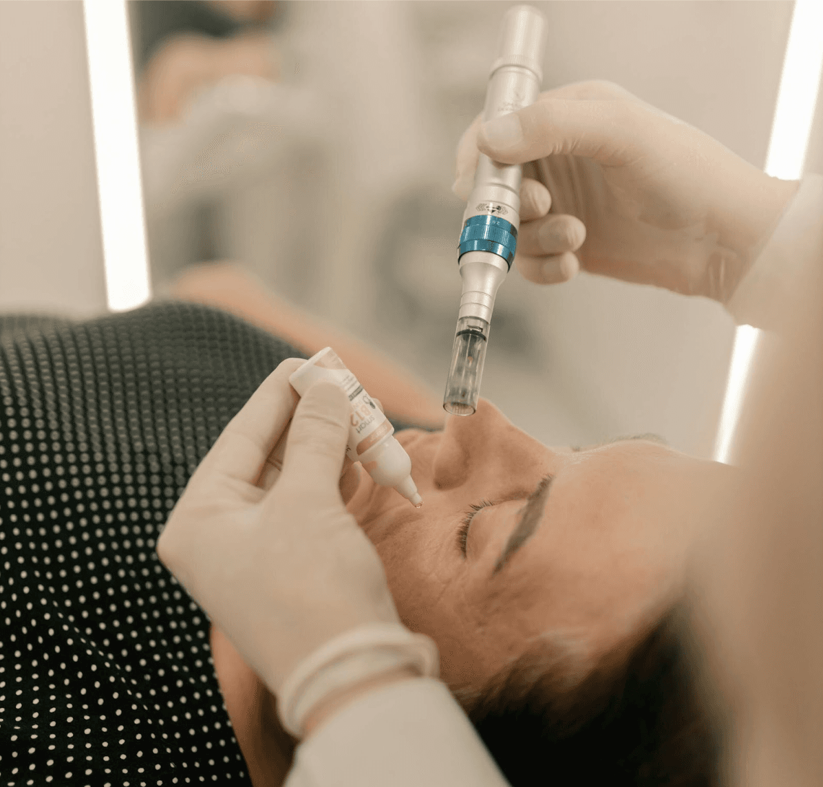 The Amazing Benefits of Microneedling