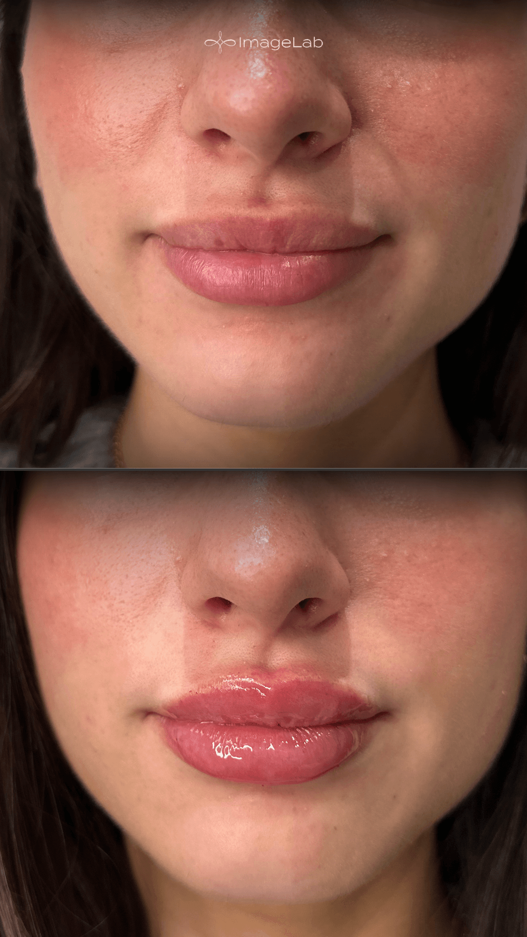 Before and after result
