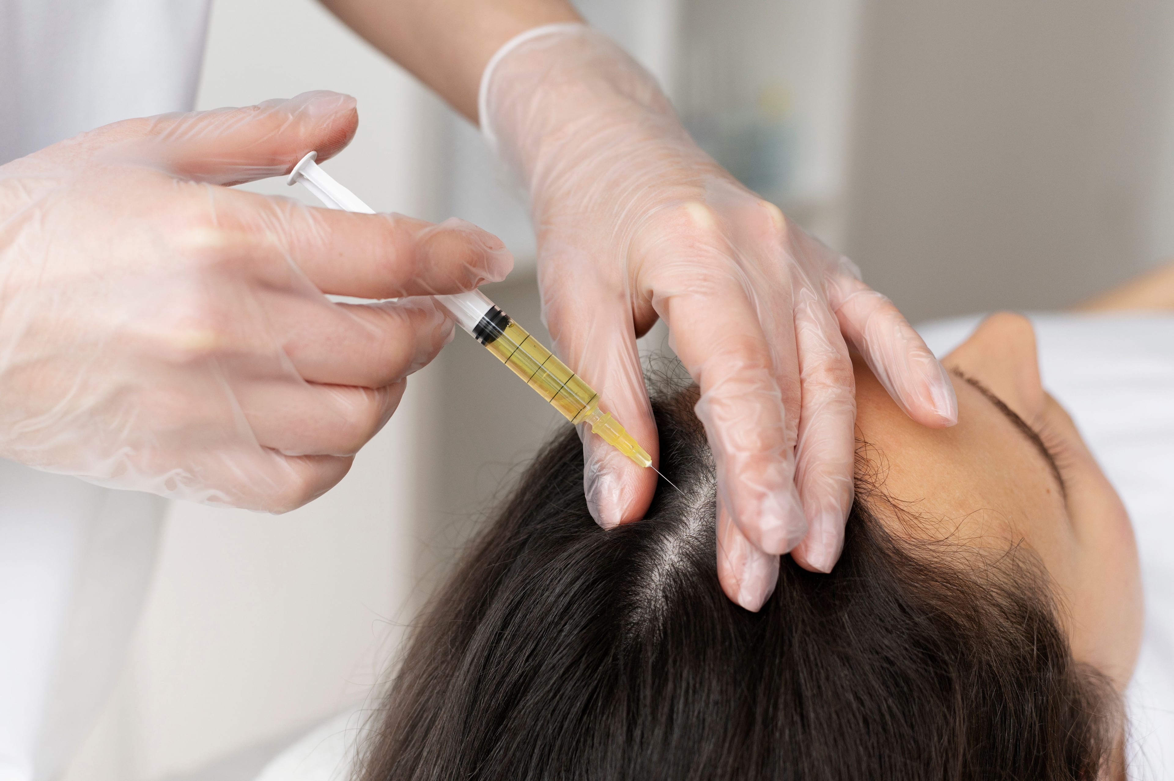 PRP Injections