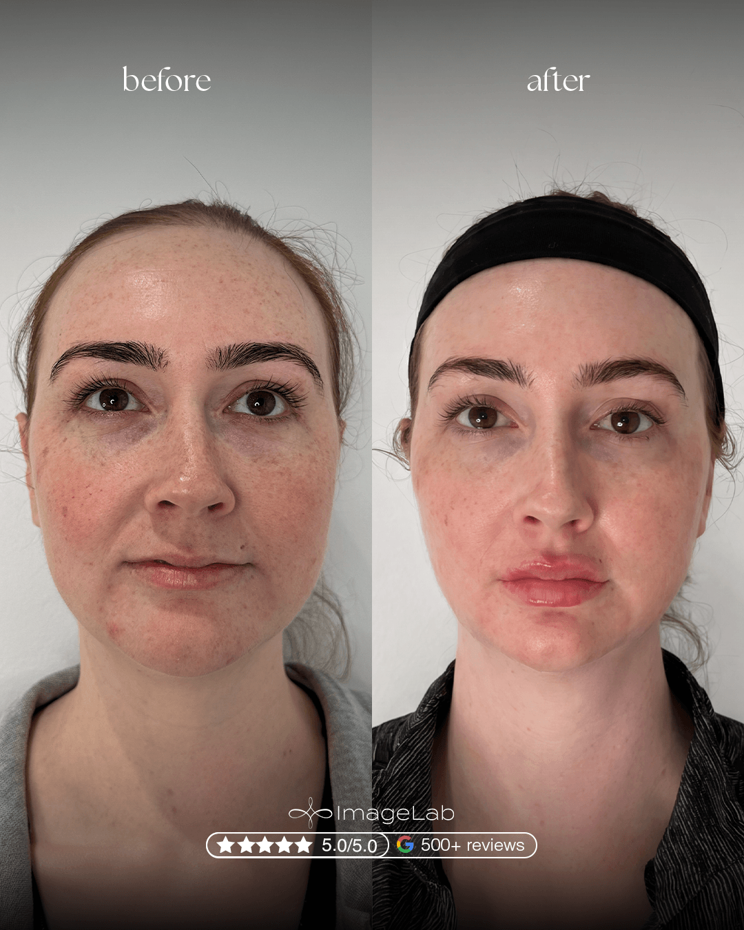 Before and after result