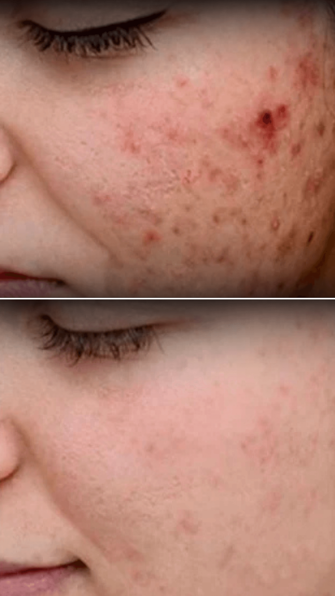 Before and after result