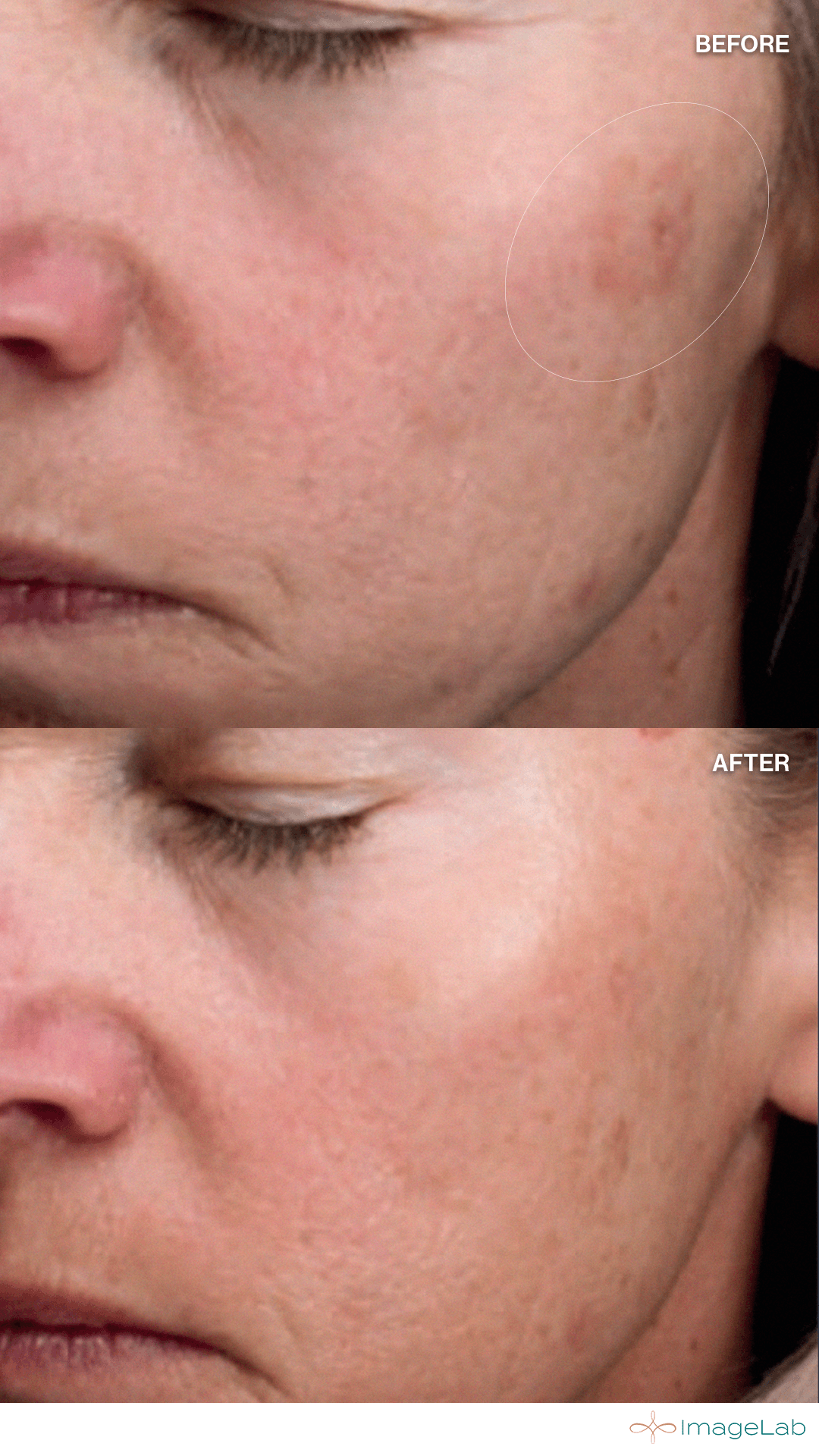 Before and after result
