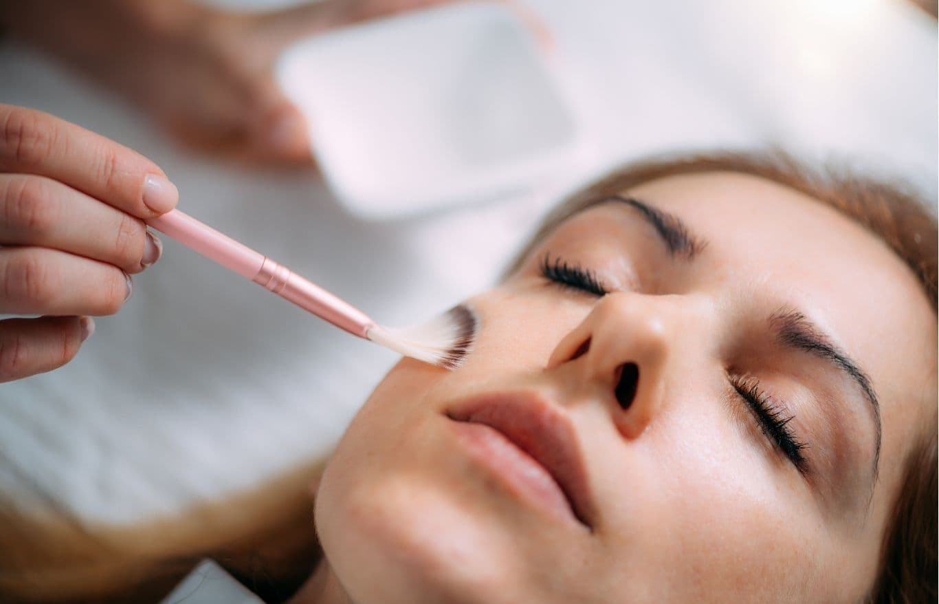 chemical peels in alexandria va