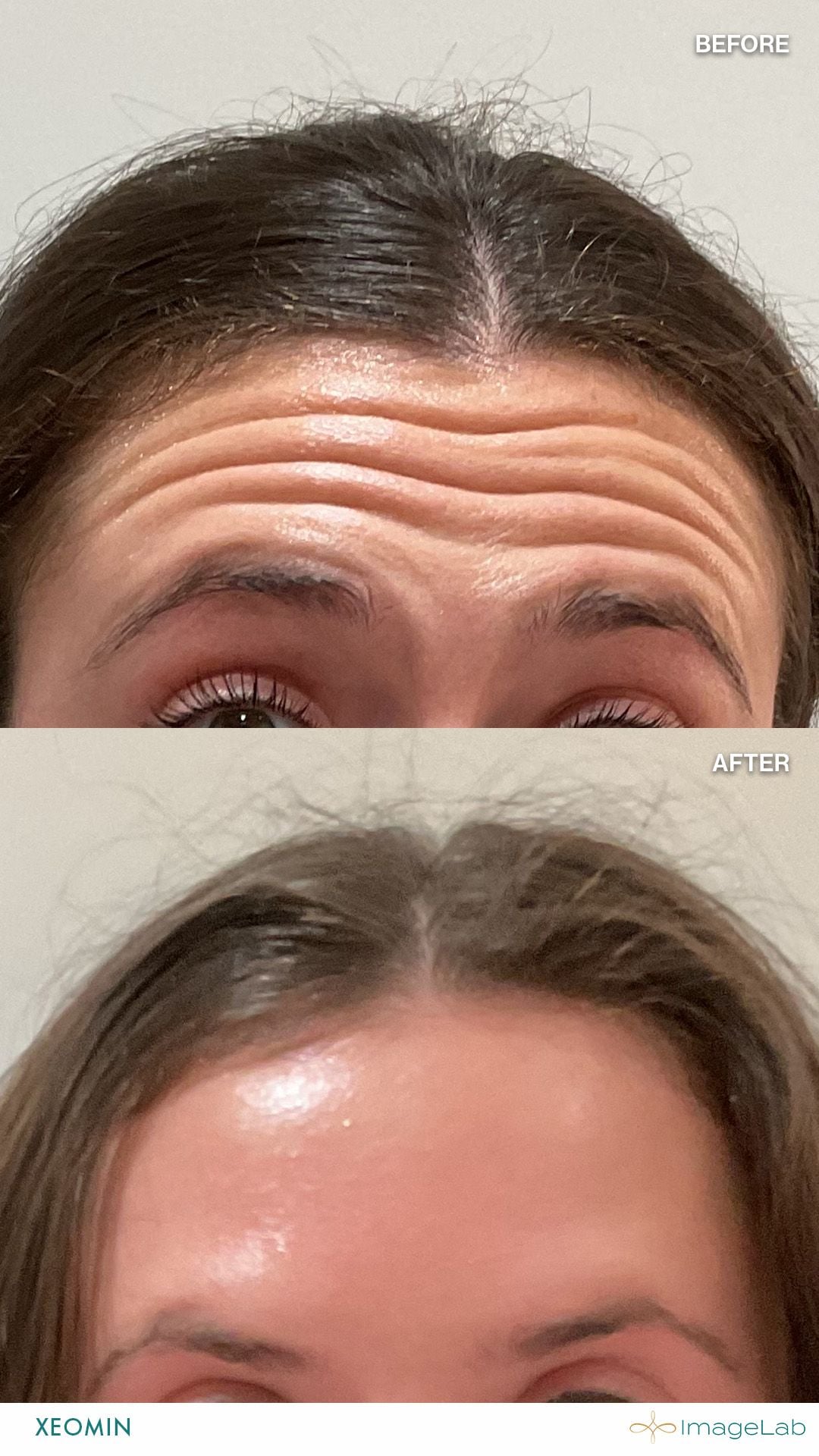 Before and after result