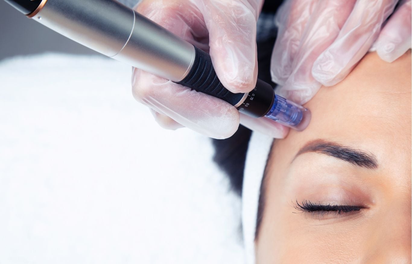 blood facial prp alexandria va