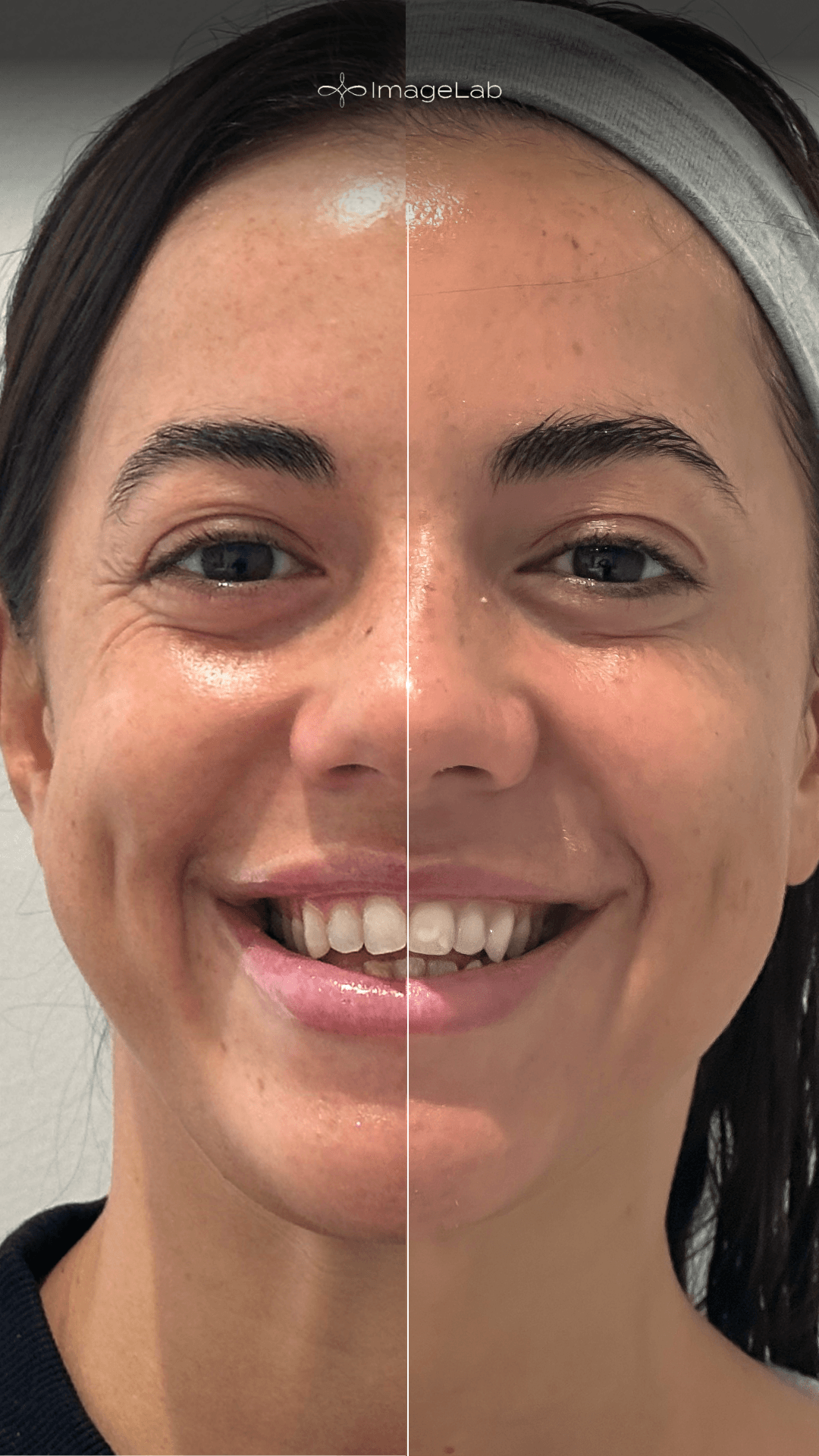 Before and after result