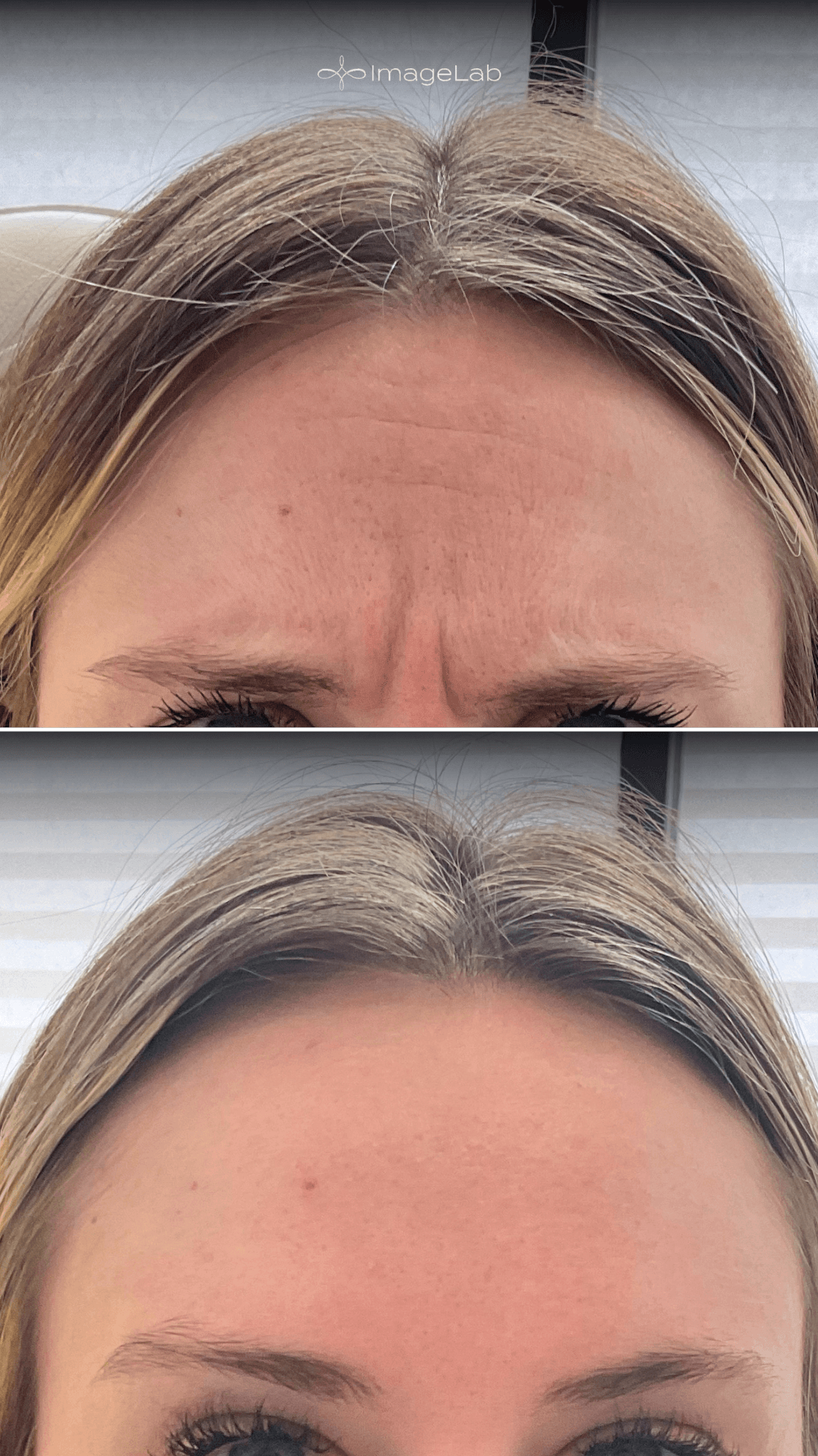 Before and after result