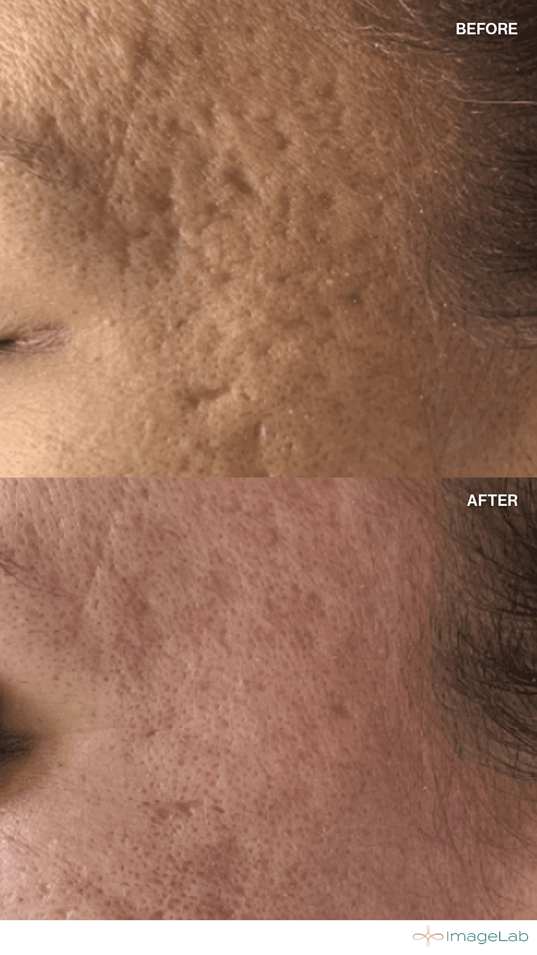 Before and after result