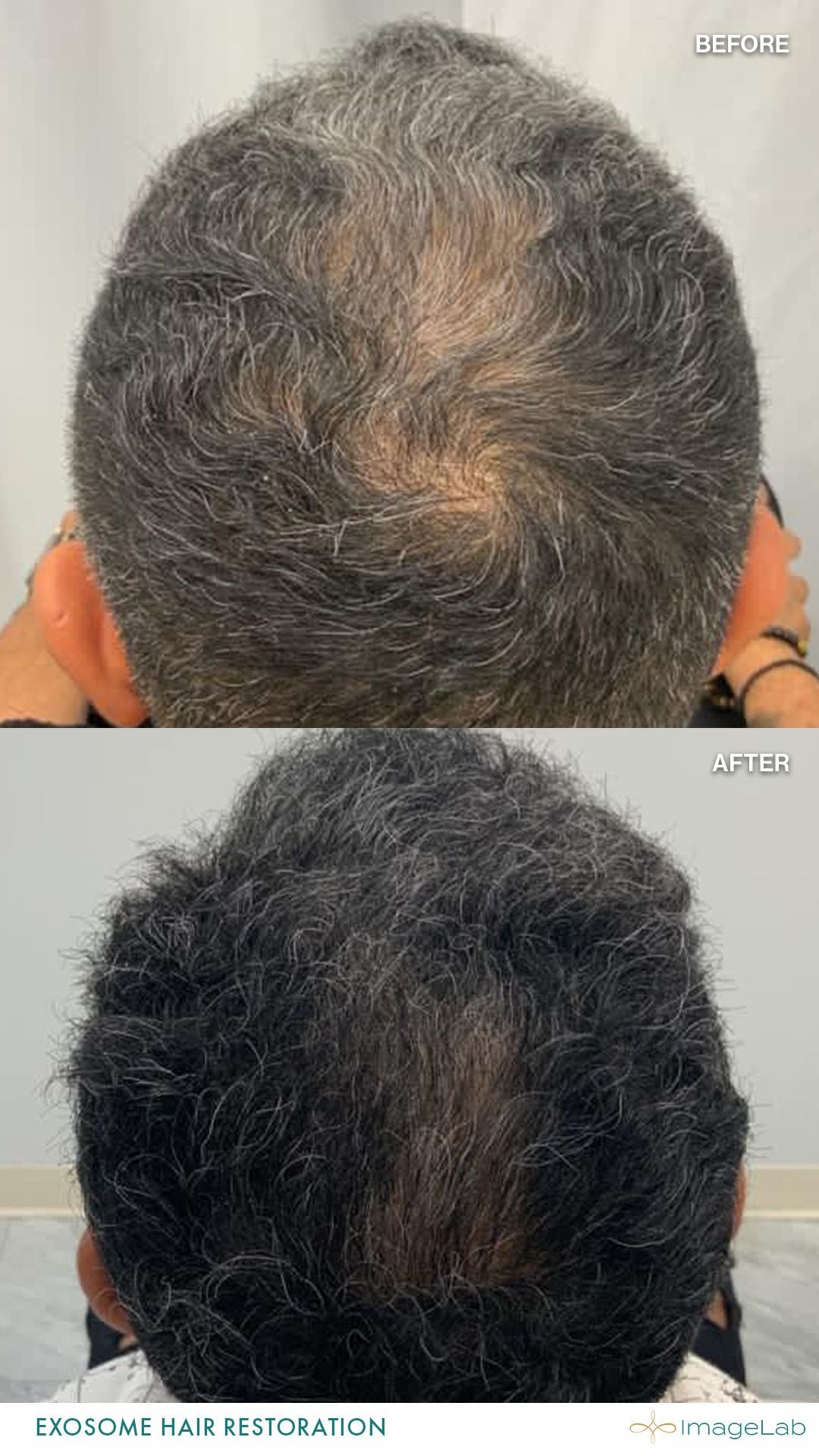 Before and after result
