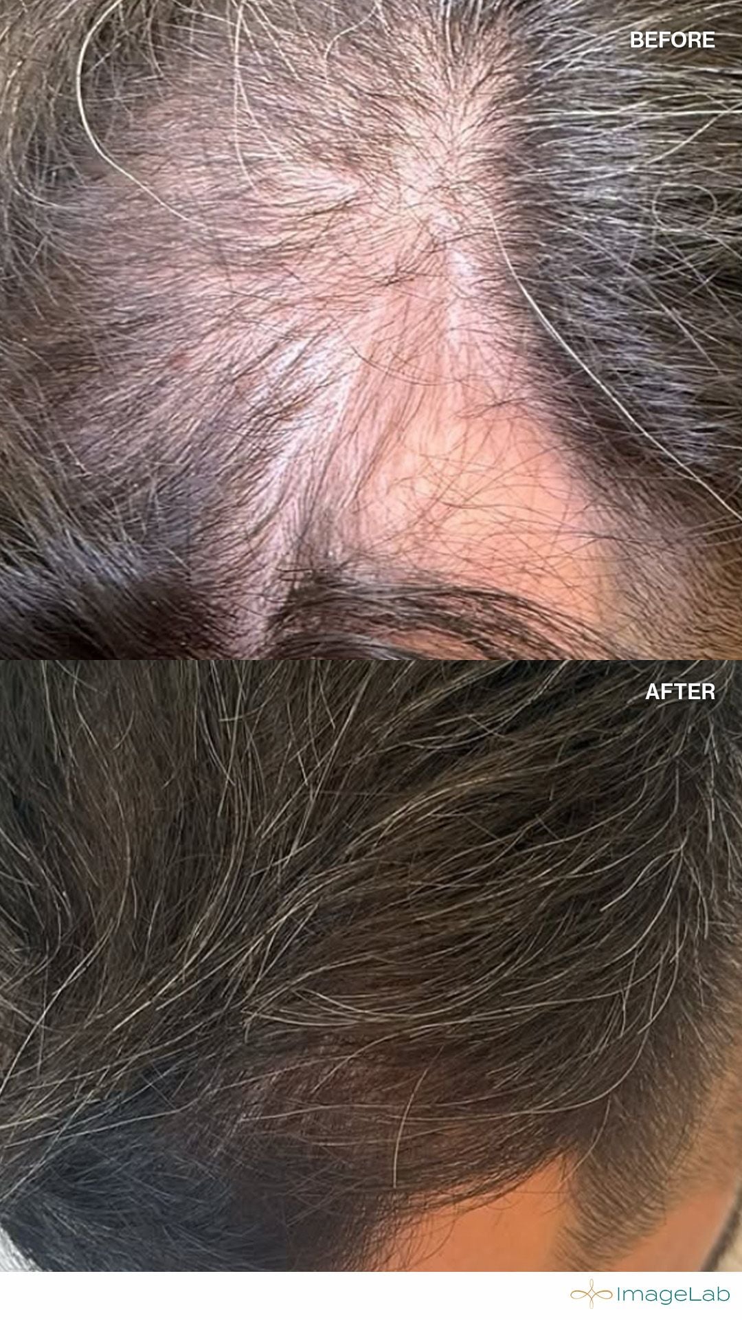 Before and after result