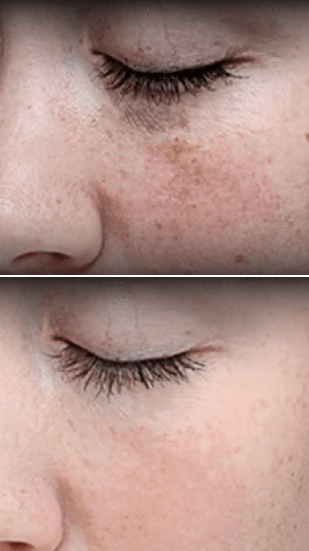 Before and after result
