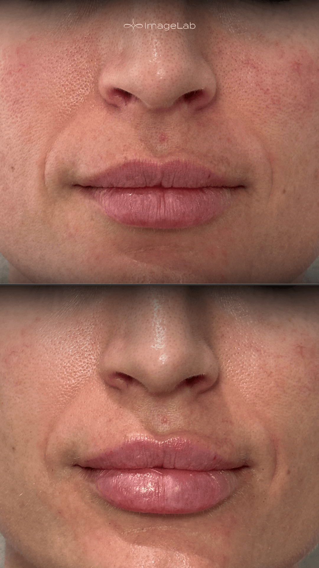 Before and after result