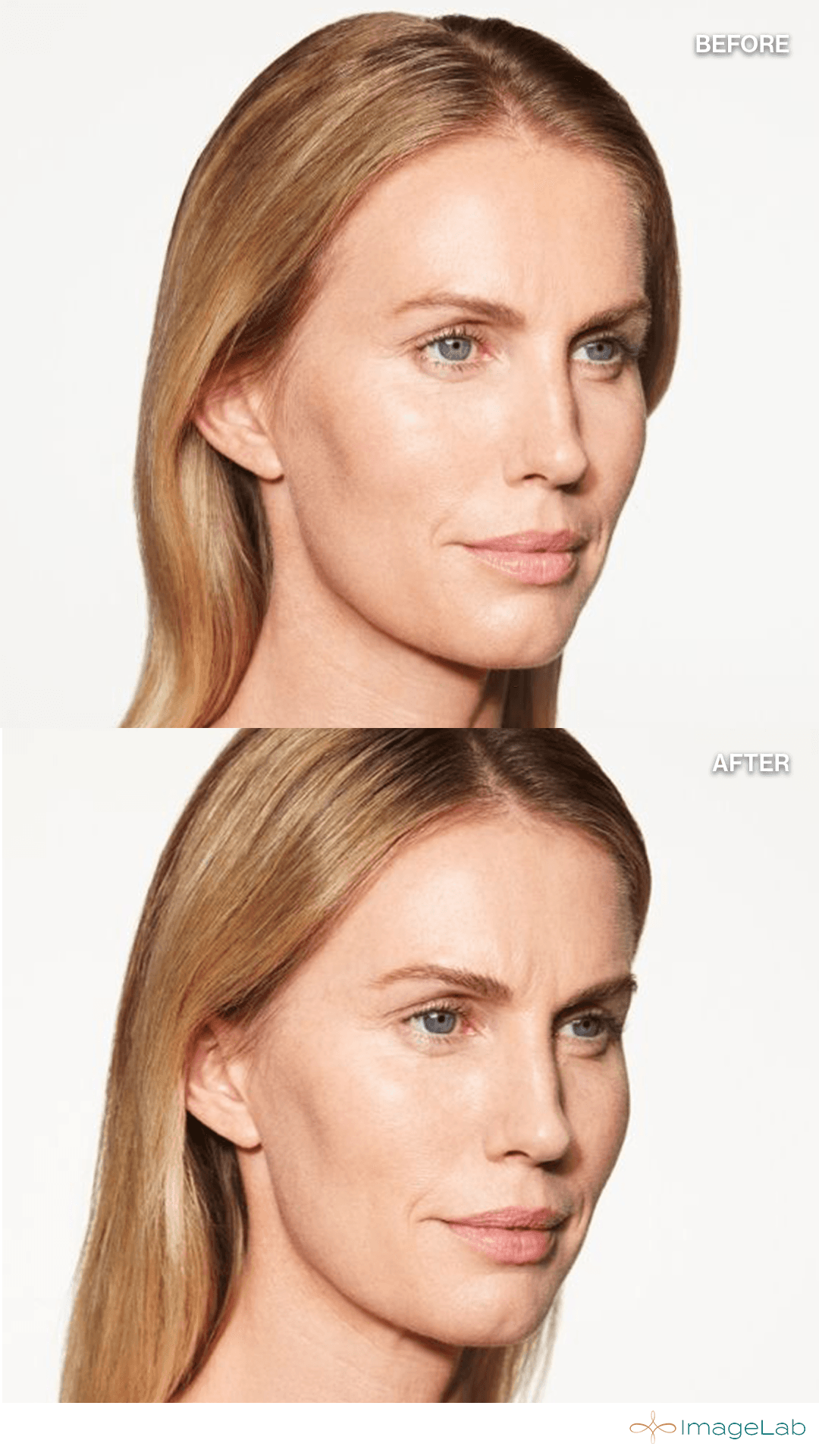 Before and after result