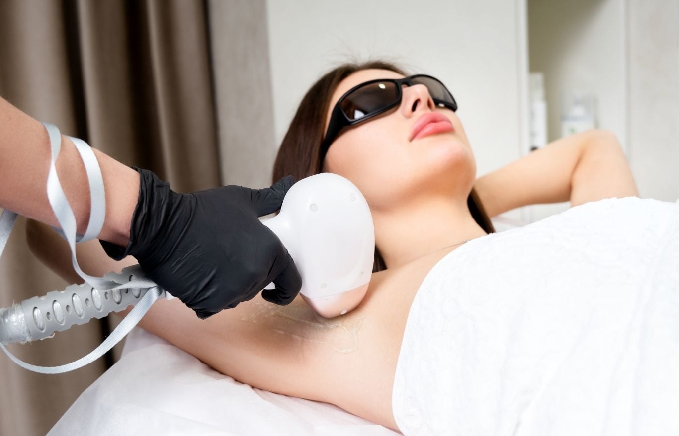 laser hair removal rockford il