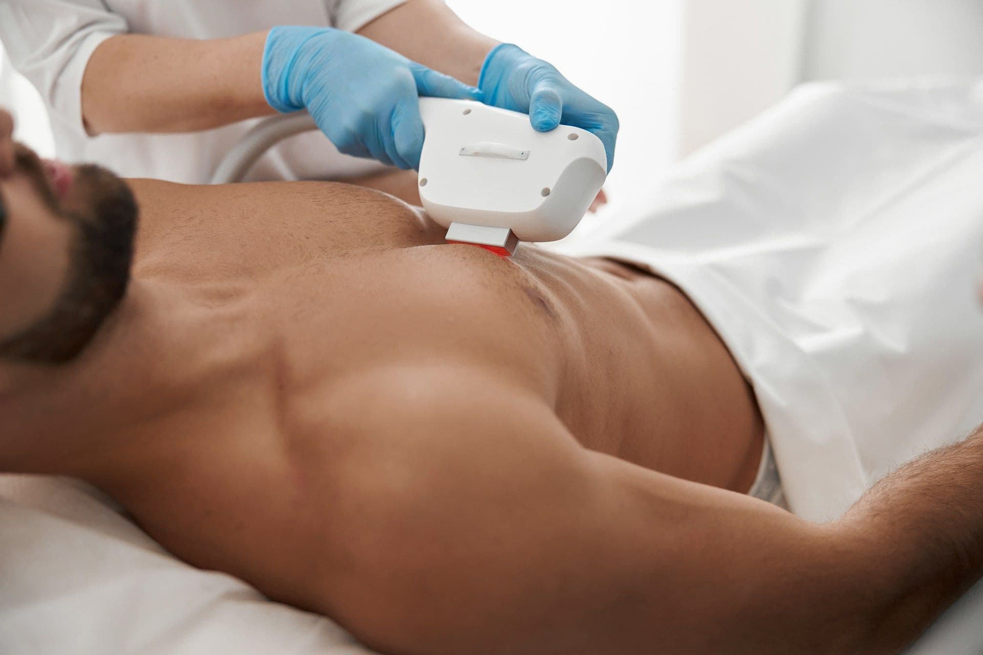 laser hair removal treatments