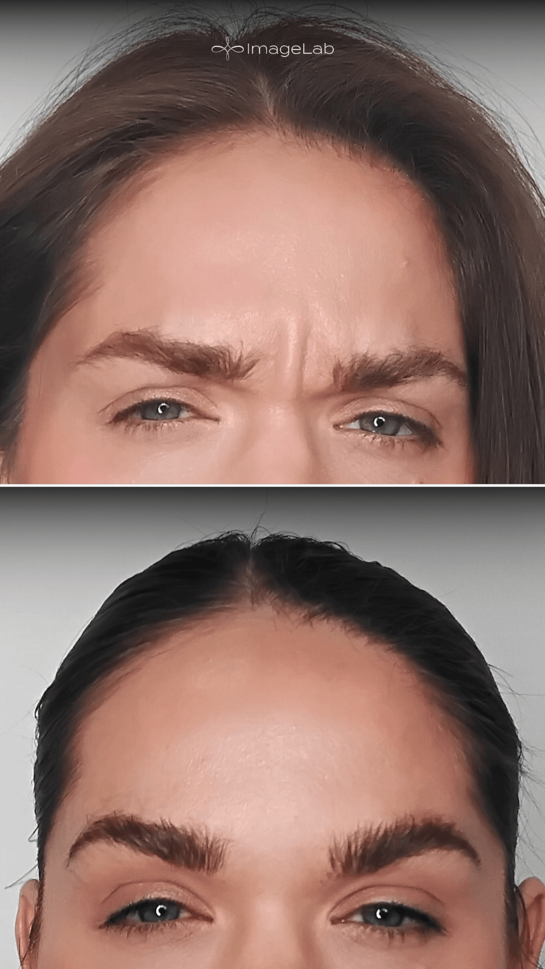 Before and after result