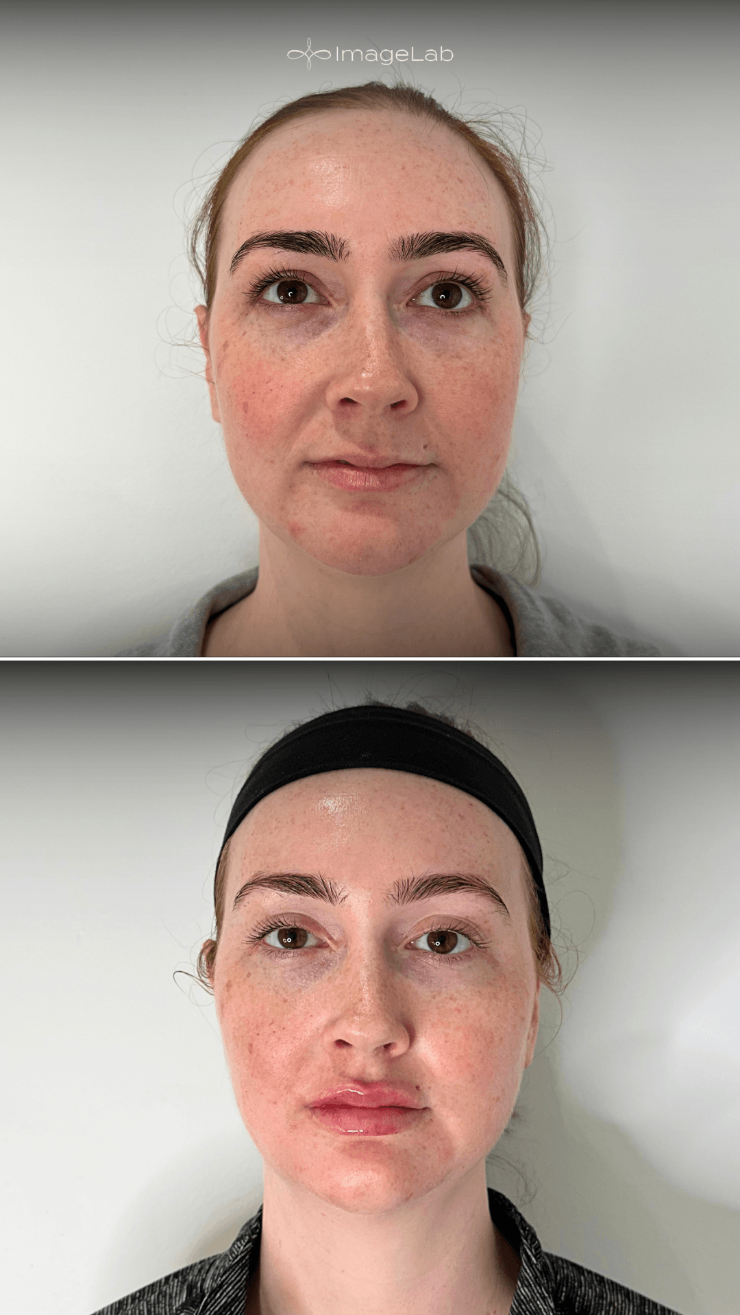 Before and after result