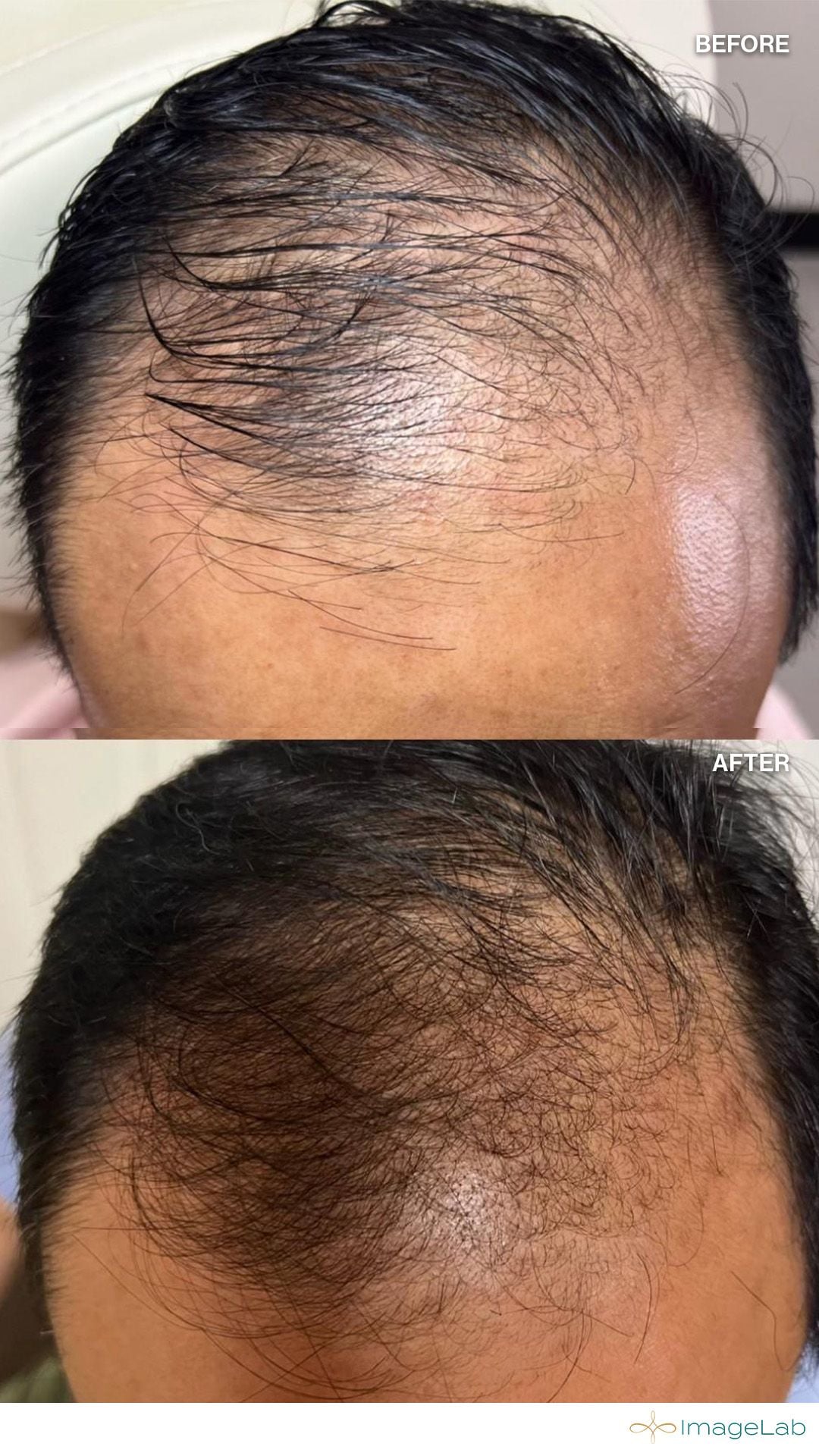 Before and after result