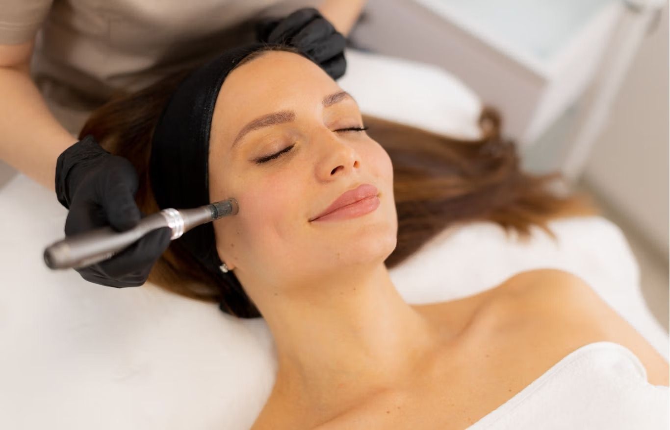 Woman receiving a facial microneedling treatment in a spa.
