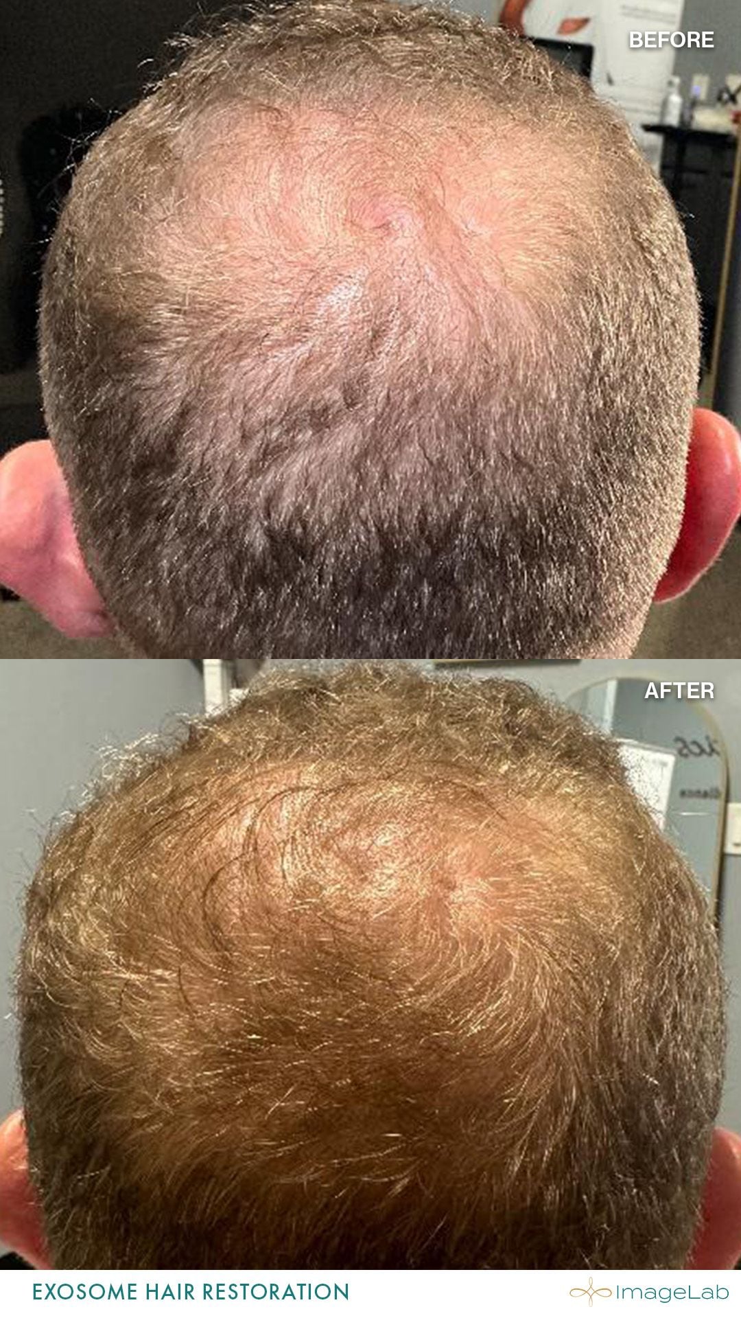 Before and after result