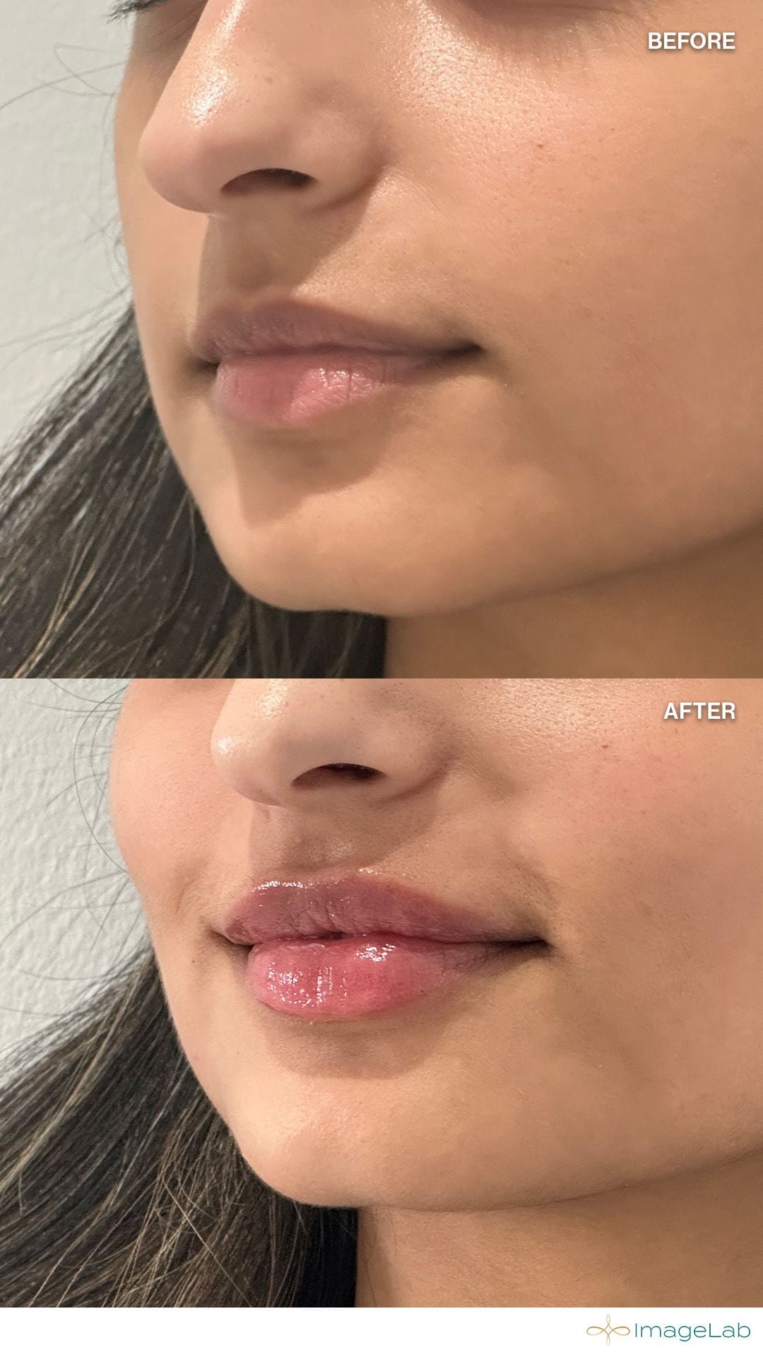 Before and after result