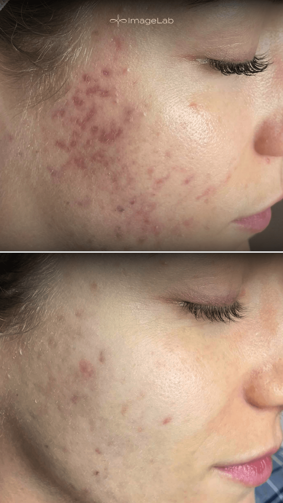 Before and after result