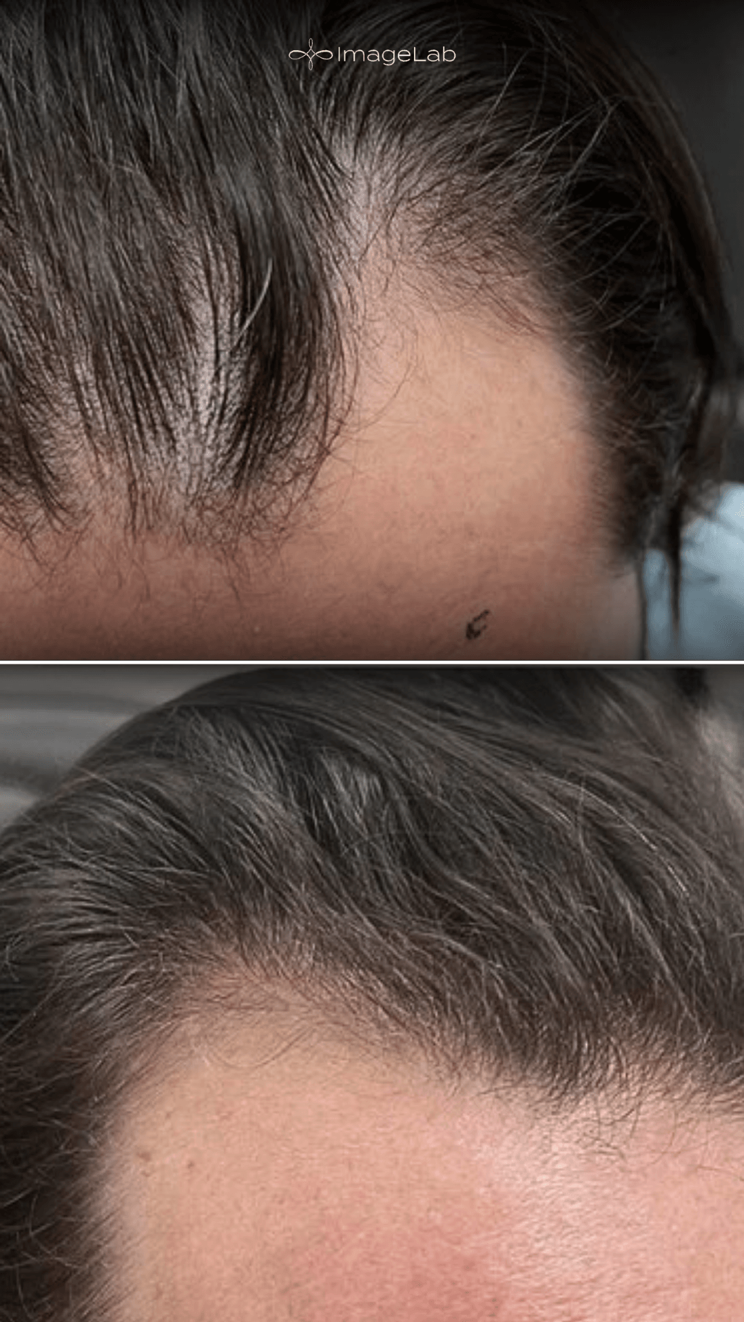 Before and after result