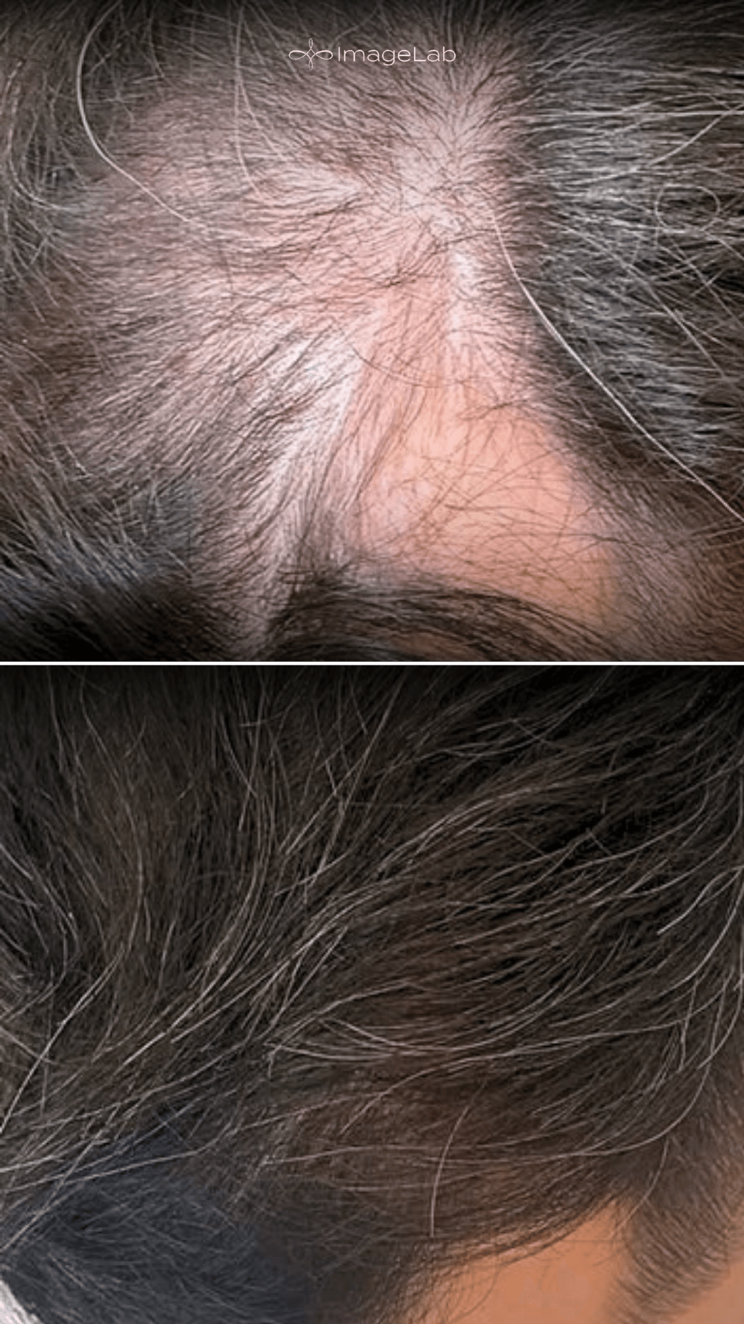 Before and after result