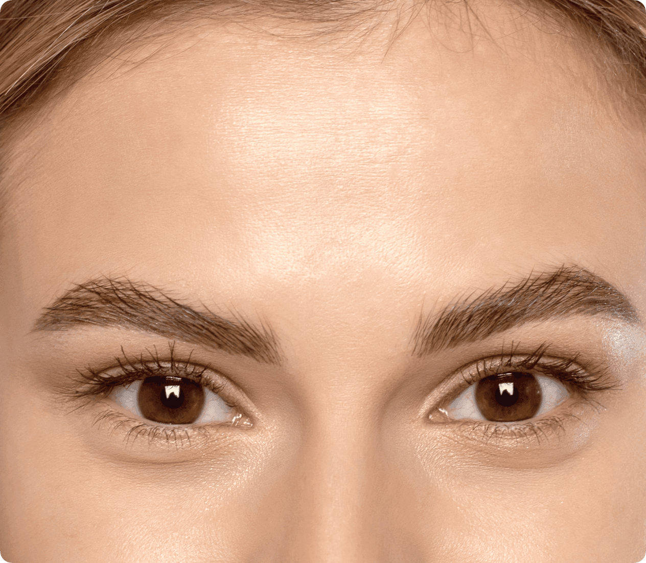 Temporary Redness and Sensitivity