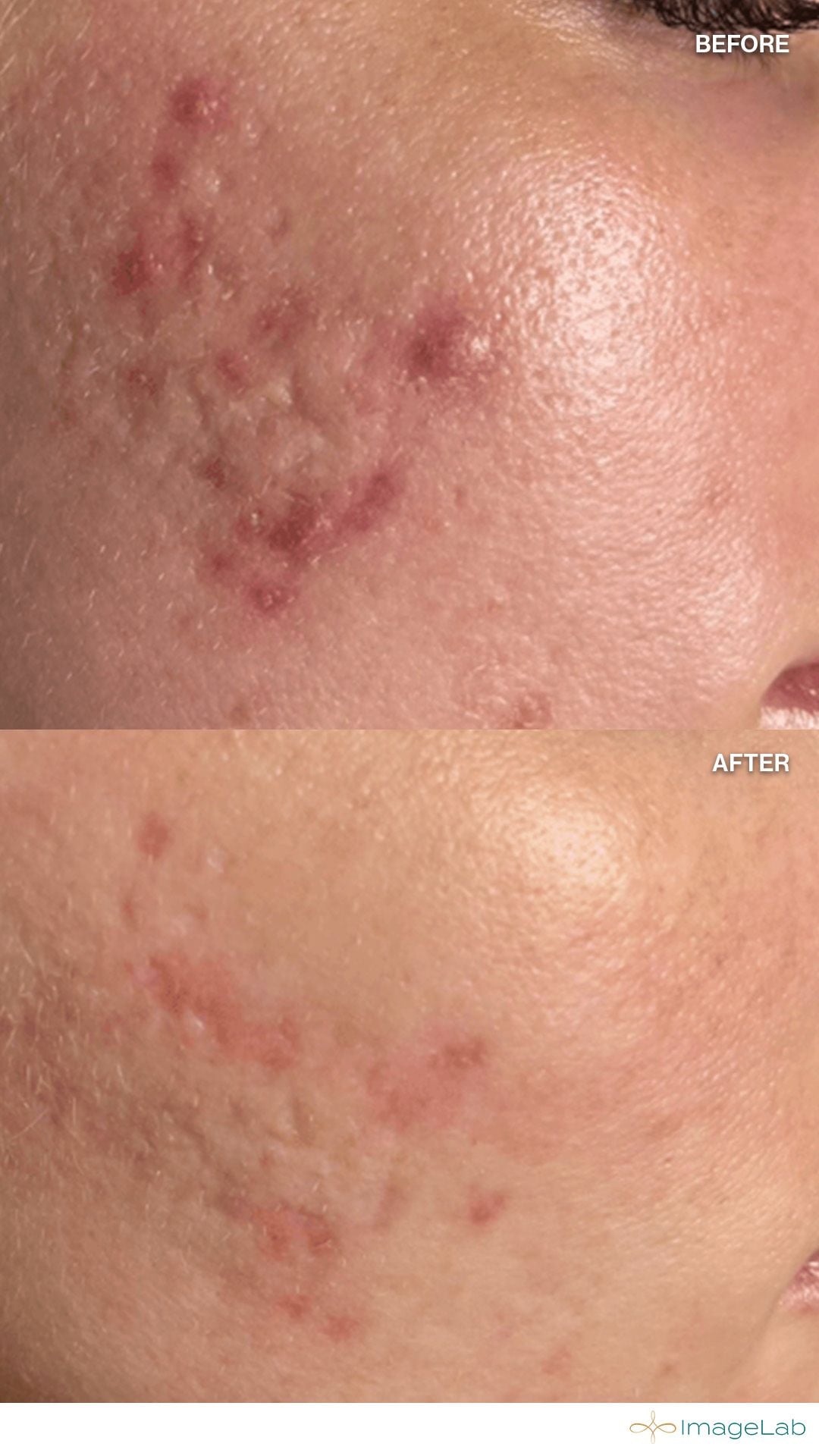 Before and after result