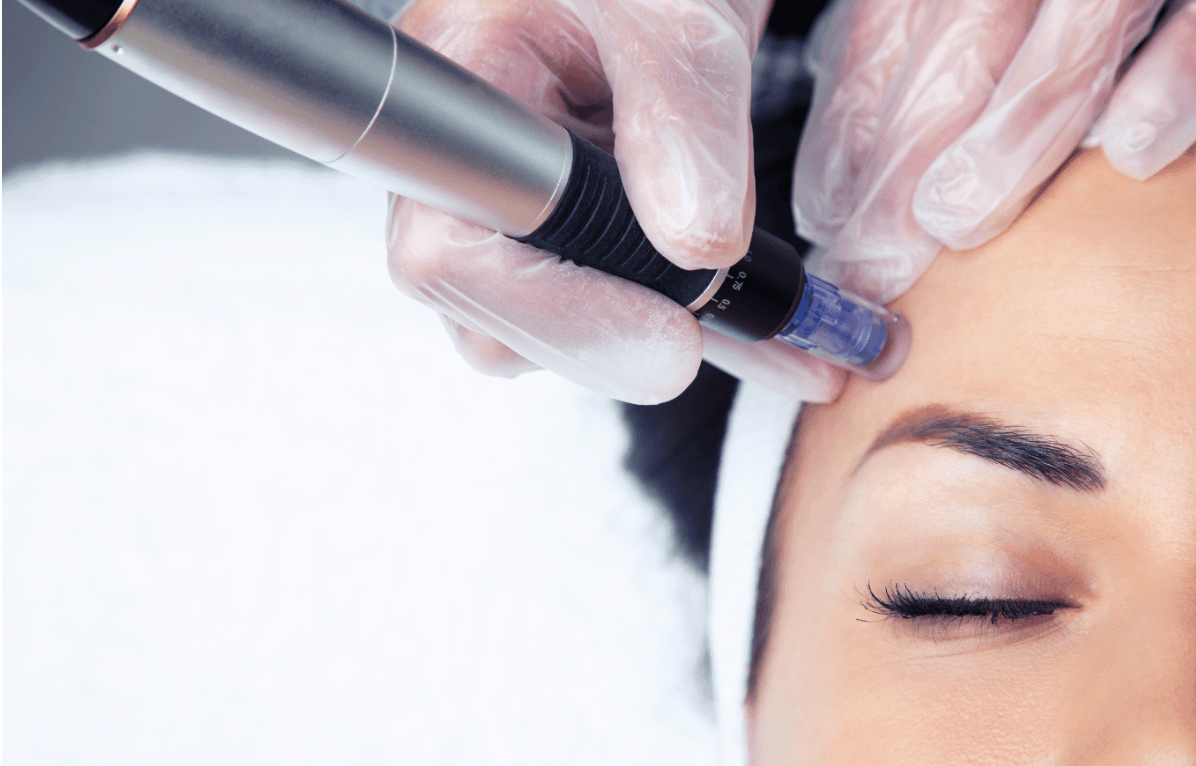 The Complete Guide to Anti-Wrinkle Treatments: Finding Your Perfect Match